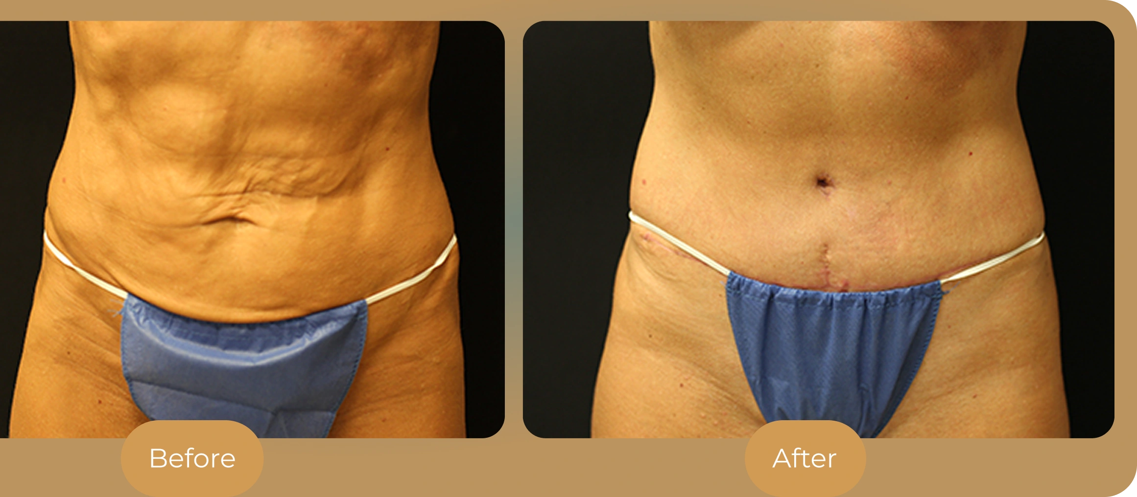 Ballantyne Plastic Surgery – Charlotte, NC