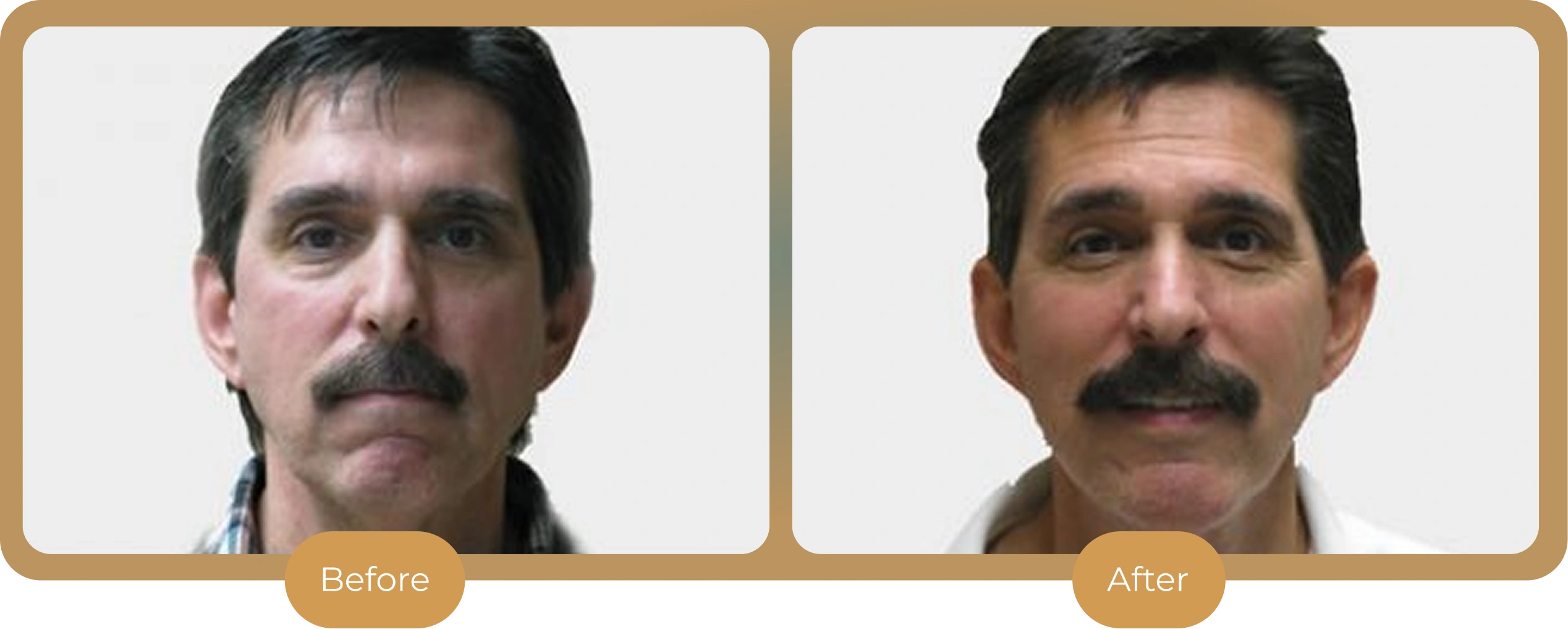 Ballantyne Plastic Surgery – Charlotte, NC