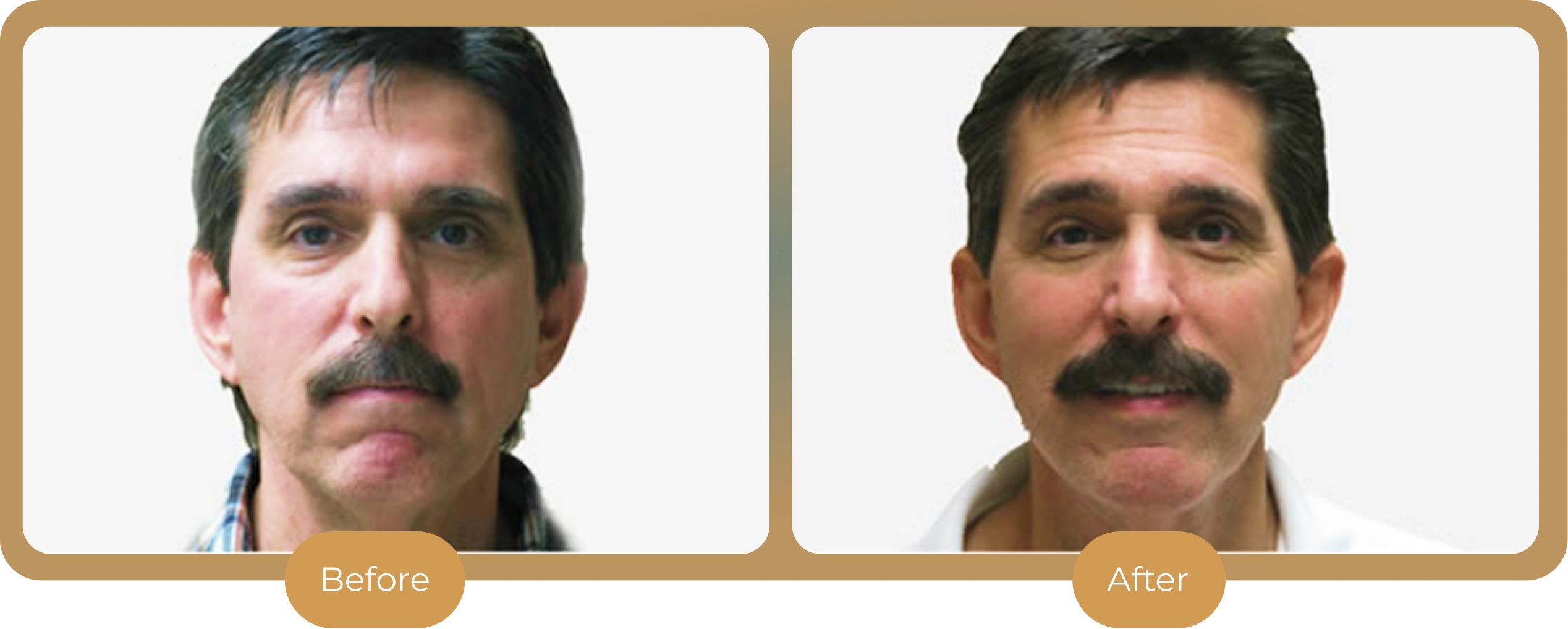 Ballantyne Plastic Surgery &ndash; Charlotte, NC