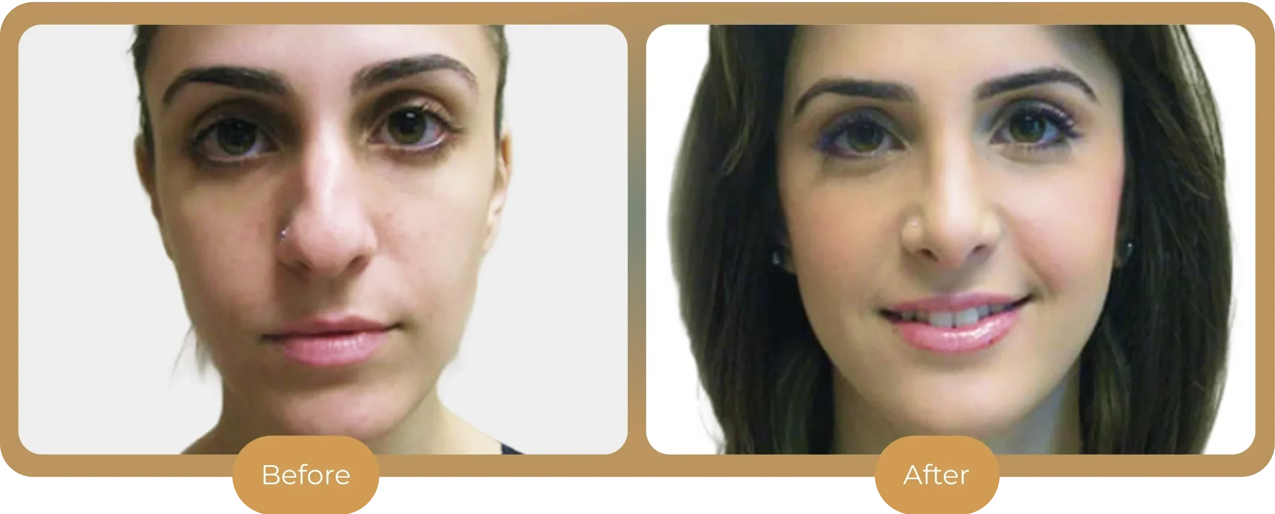 Ballantyne Plastic Surgery &ndash; Charlotte, NC