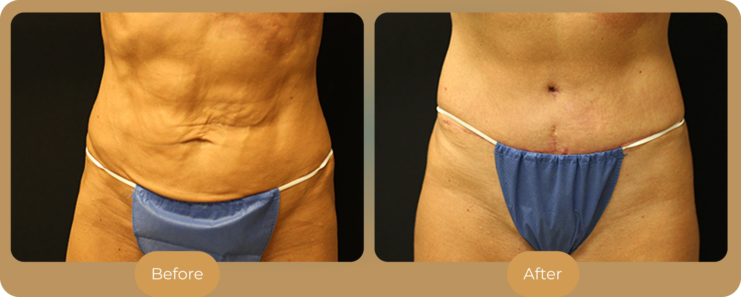 Ballantyne Plastic Surgery – Charlotte, NC