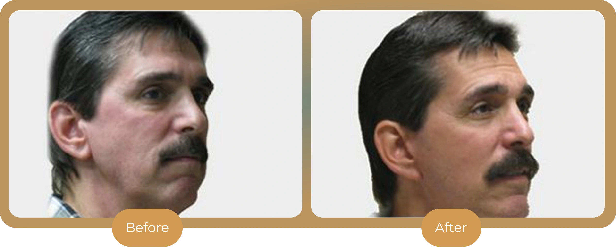 Ballantyne Plastic Surgery – Charlotte, NC