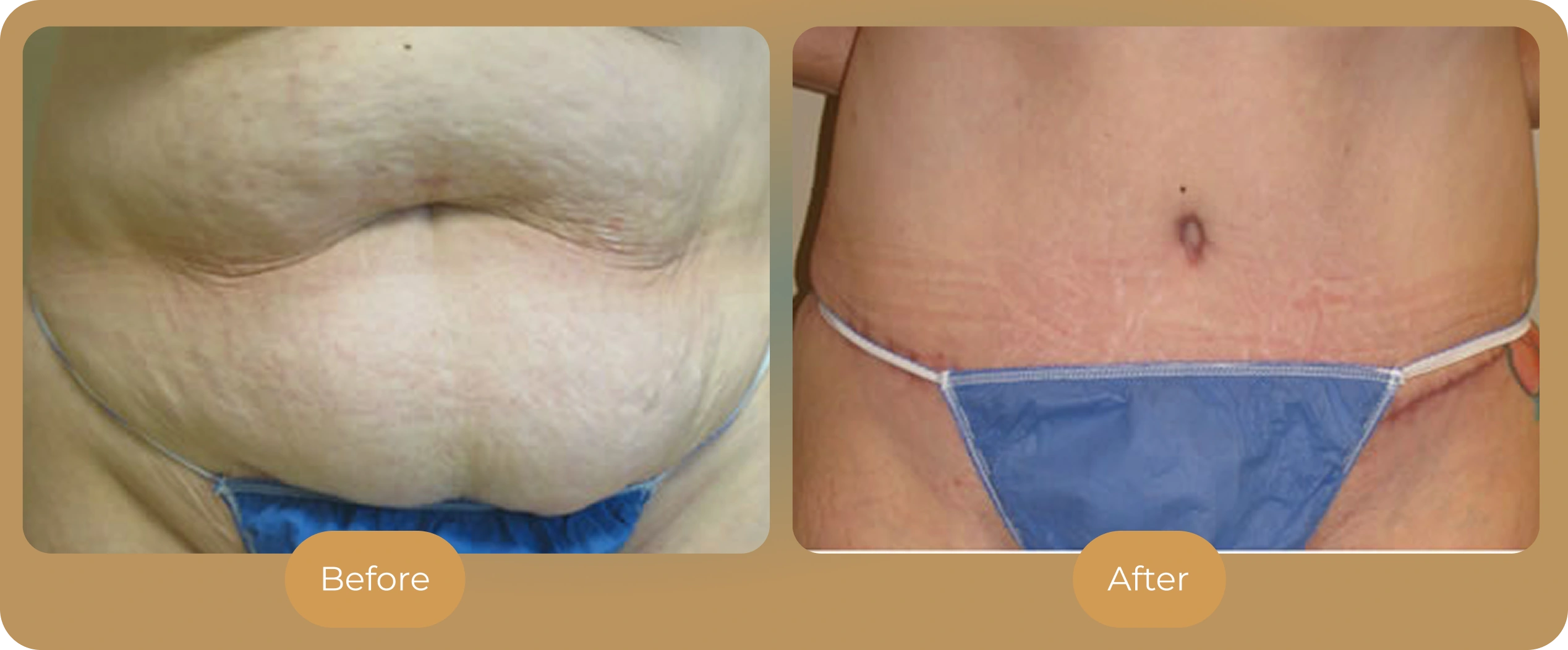 Ballantyne Plastic Surgery – Charlotte, NC