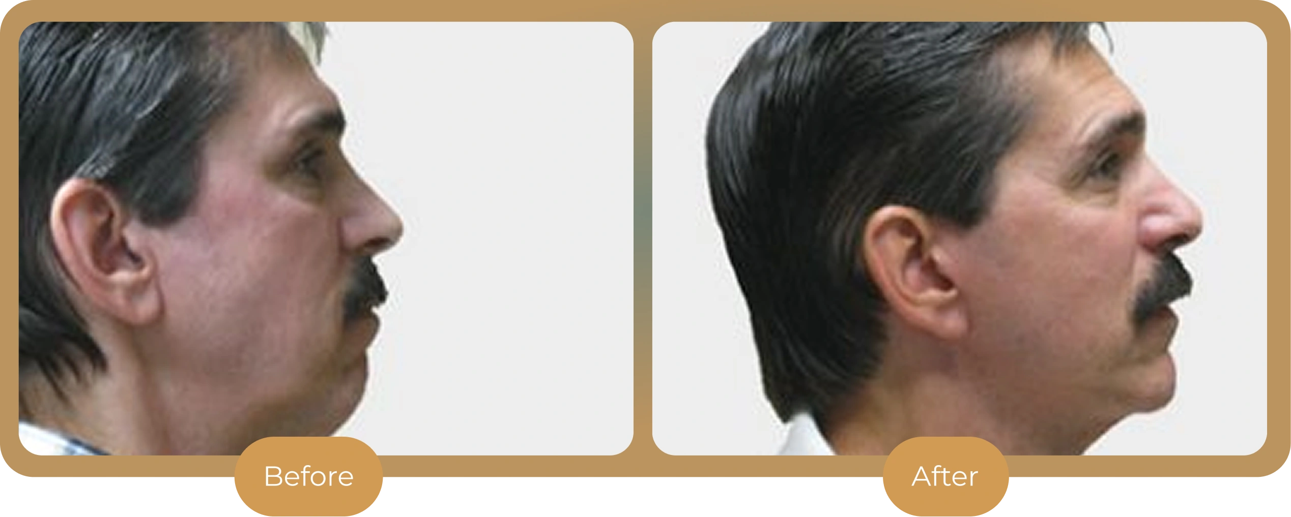 Ballantyne Plastic Surgery – Charlotte, NC
