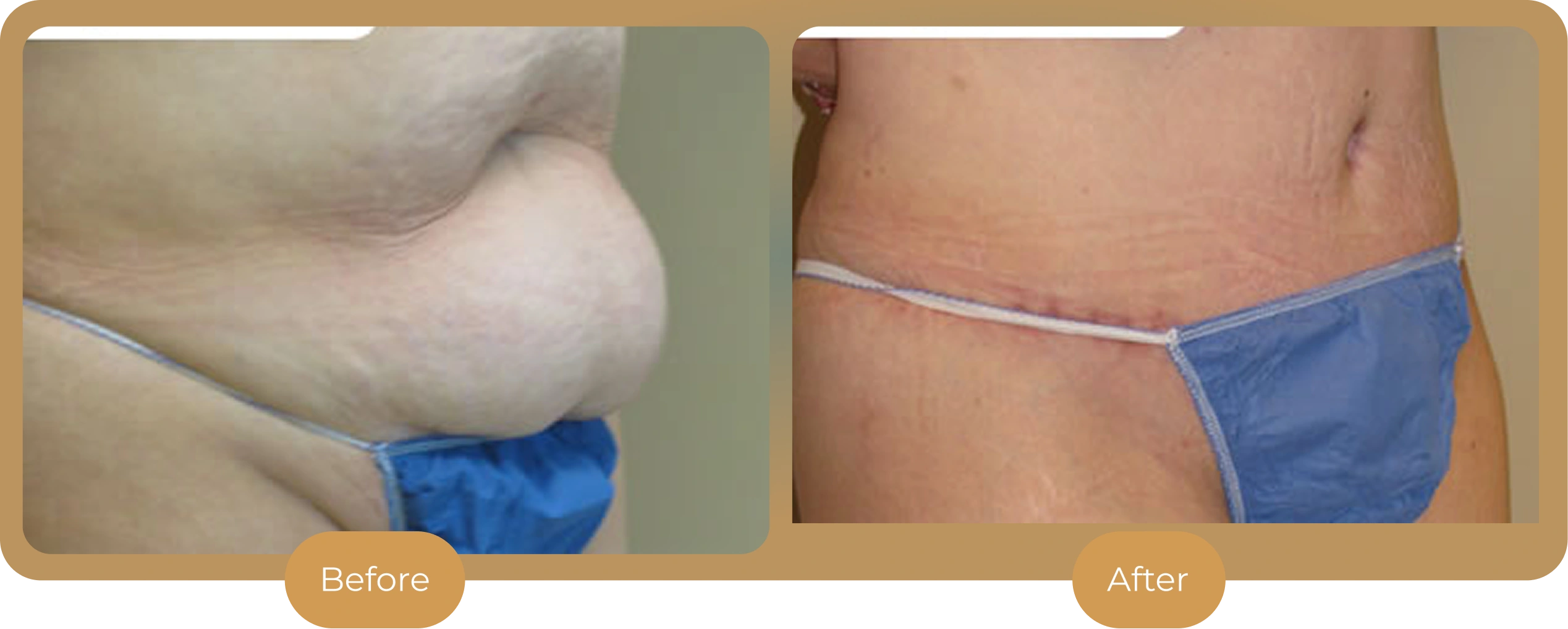 Ballantyne Plastic Surgery – Charlotte, NC