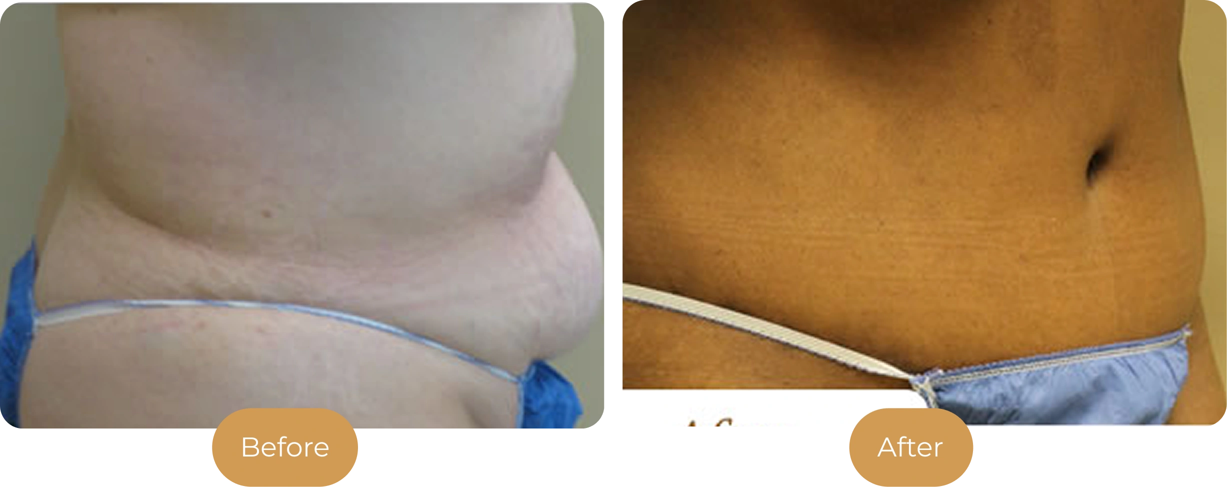 Ballantyne Plastic Surgery – Charlotte, NC