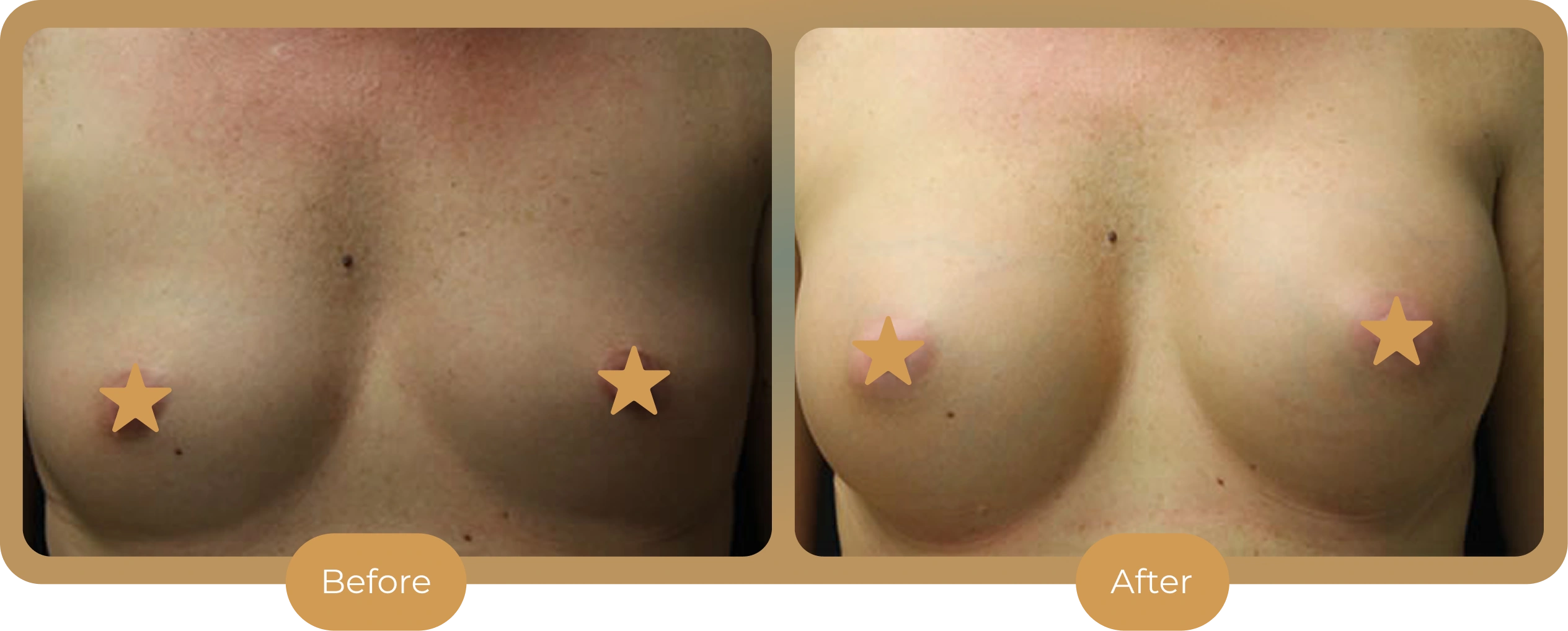 Ballantyne Plastic Surgery – Charlotte, NC