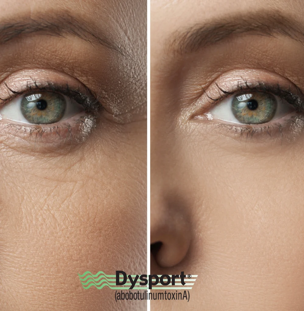 Ballantyne Plastic Surgery – Charlotte, NC