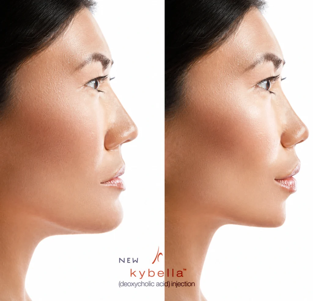 Ballantyne Plastic Surgery – Charlotte, NC