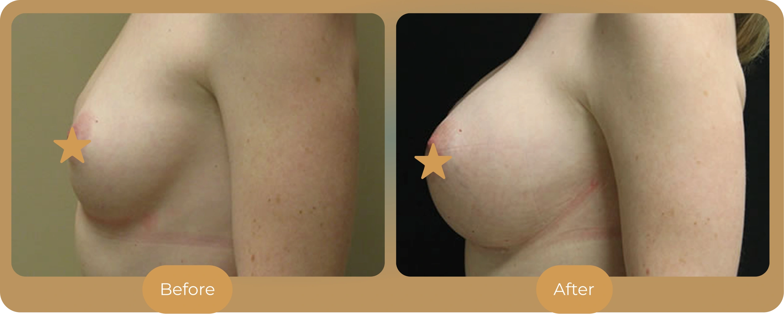 Ballantyne Plastic Surgery – Charlotte, NC