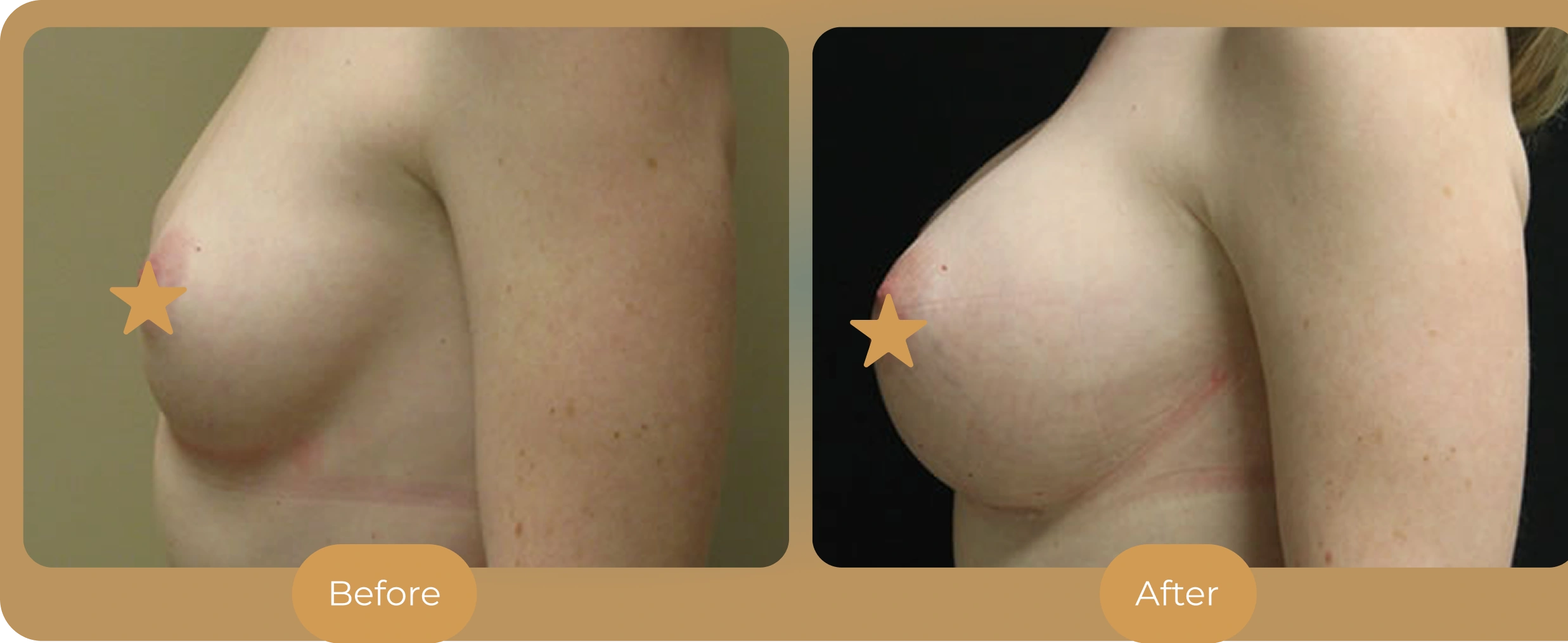 Ballantyne Plastic Surgery – Charlotte, NC