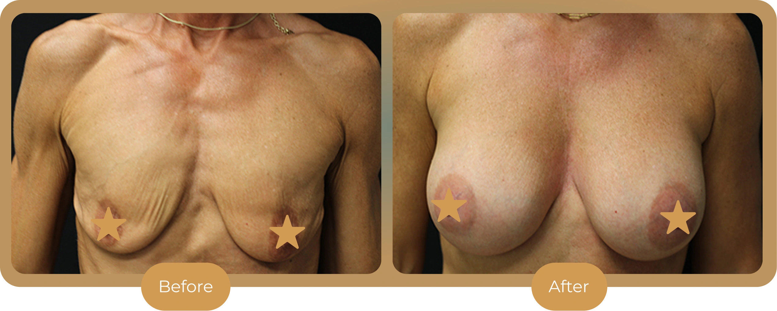 Ballantyne Plastic Surgery – Charlotte, NC